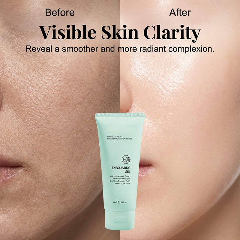 🔥1 acheté, 1 offert🎁 Gel exfoliant éclaircissant aux extraits de plante – Formule douce végétale, exfoliation efficace & soin unifiant pour la peau 🧴